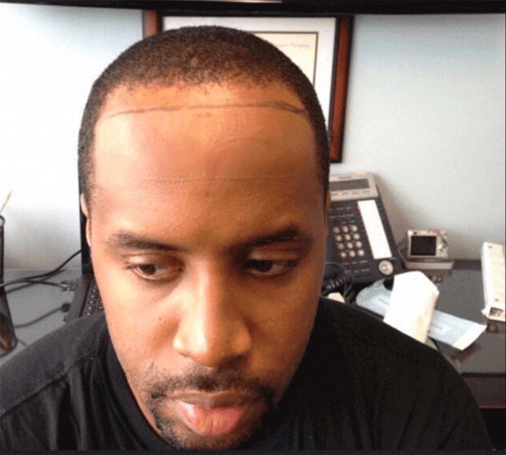 24. Follicle Feuds w/ Jordan